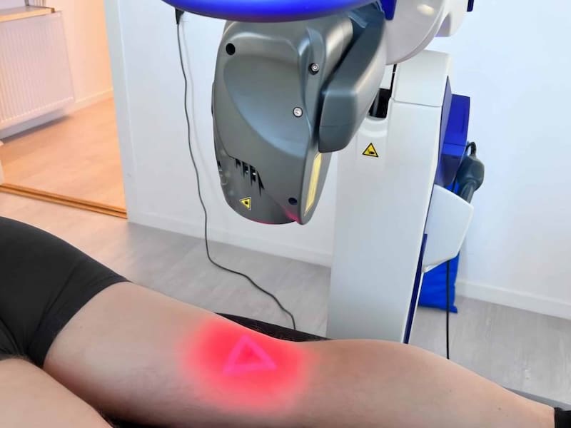 Laserbehandling som en del af et behandlingsforløb